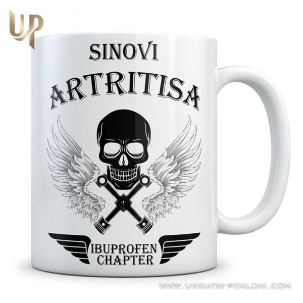 sinovi artritisa 1